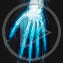ręce dłonie dłoń ręka palce rentgen rtg prześwietlenie