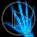kości kość ręce dłonie dłoń ręka palce rentgen zdjęcie