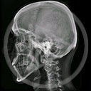 czaszka kościotrup szkielet horror rentgen czaszki zdjęcie straszne czacha