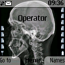 kości czaszka głowa rentgen czaszki czacha